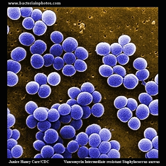 staph aureus vancomycin intermediate resistant